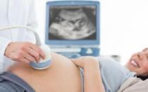 孕妇做梅毒血清试验的注意事项