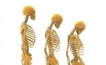 哪些方法可以预防骨质疏松