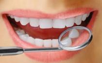 揭秘对洗牙的误区有哪些