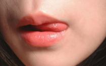 嘴唇容易脱皮是内因还是外因 嘴唇干裂脱皮缓解偏方